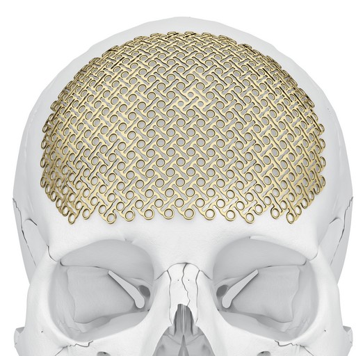 12021C_Matrix_NEURO_Frontal_05