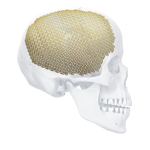 12021C_Matrix_Neuro_FTP_90