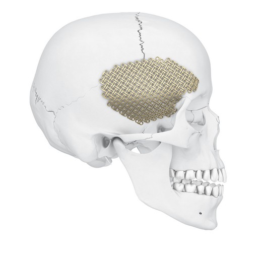 12021C_Matrix_NEURO_Temporal_01