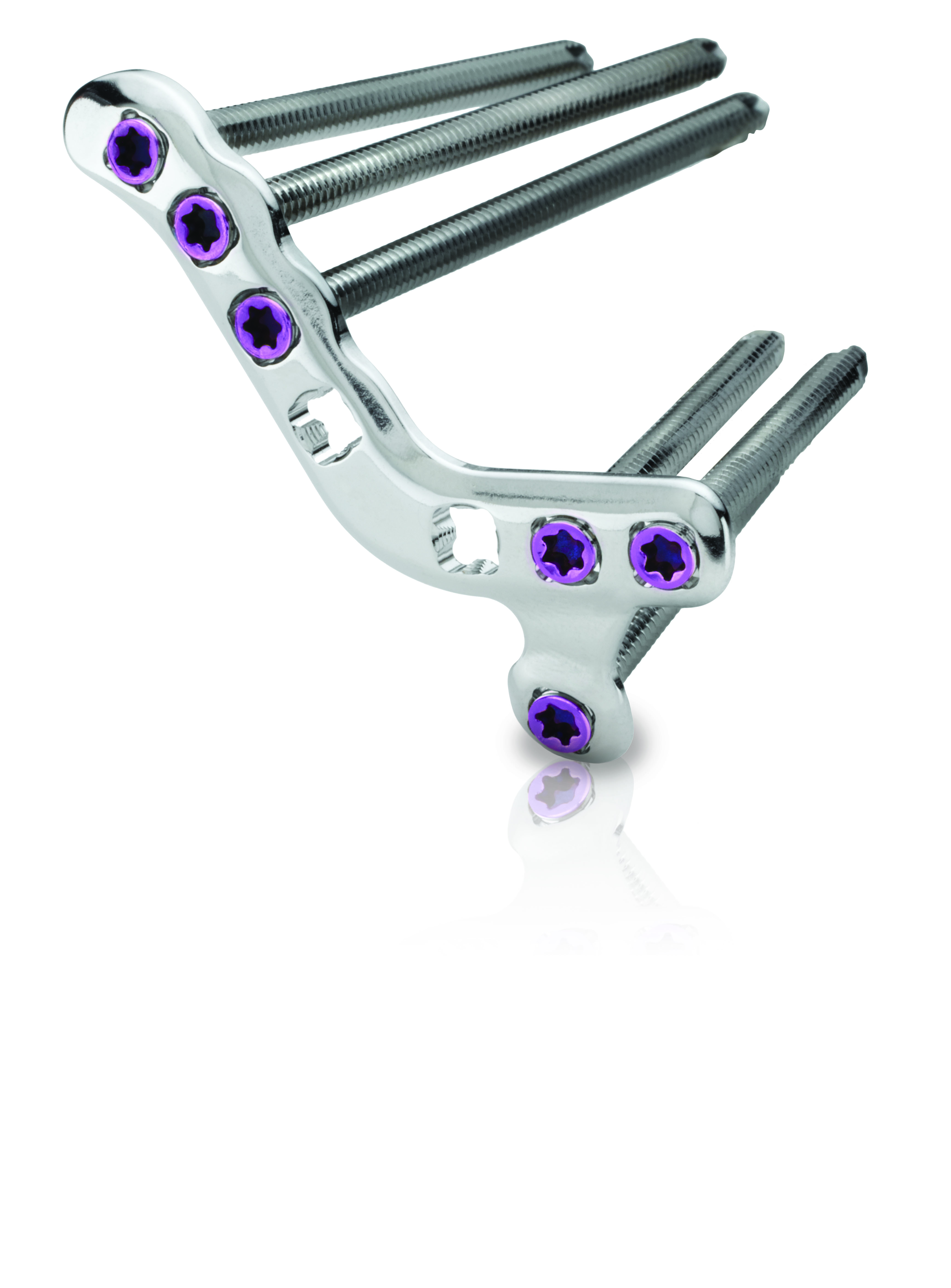 AnterolateralCalcaneusPlate