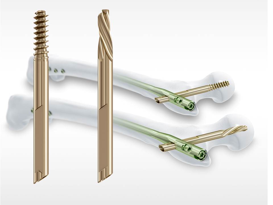 FrontPageTFNAPicture