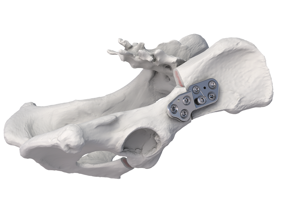 12668B_Canine_DPO_screw_in_Cover DPO Abstract