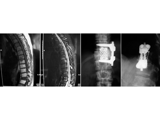 TKcdB0021b Fig.1  MRls and x-rays