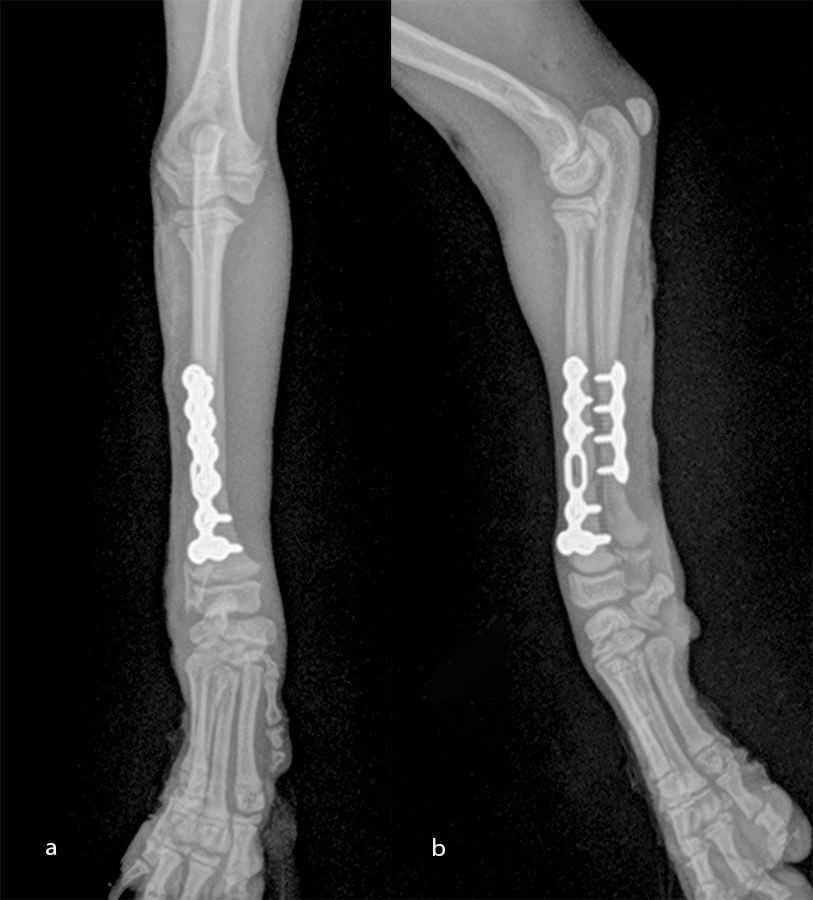 Fig-12 case 2 post op 1