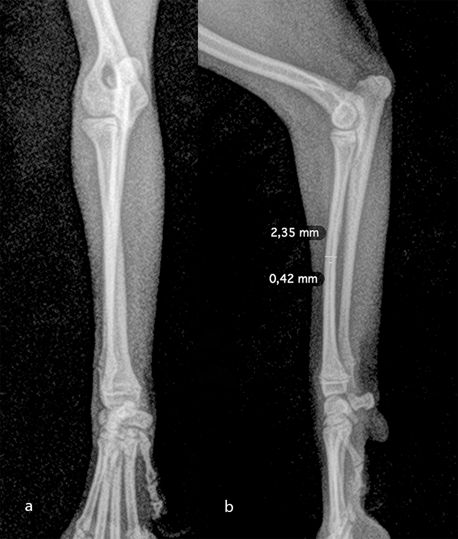 Fig-7 Case 2 pre op 2