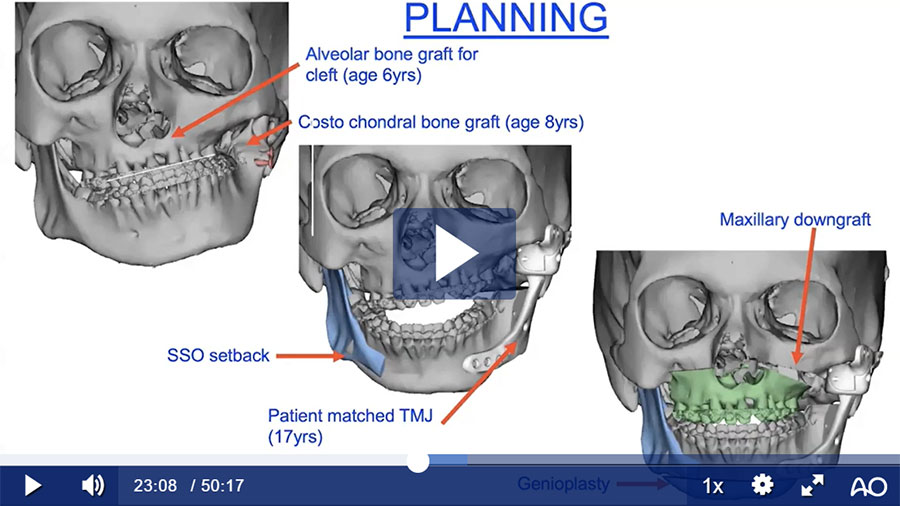 Blog presentation video