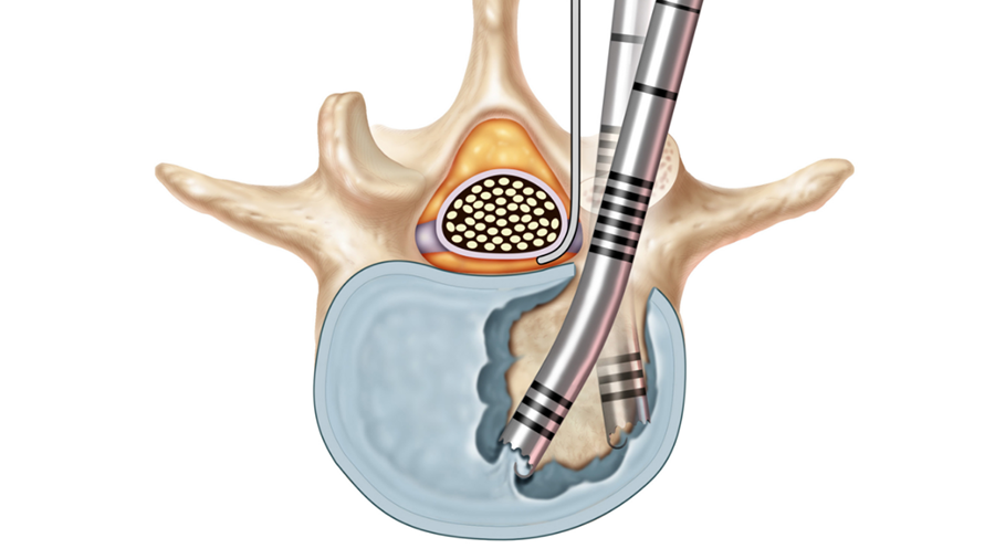 Concorde clear promo