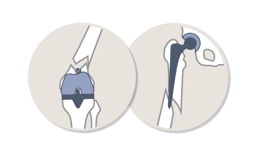 AO Recon Curricula_Comprehensive Periprosthetic Fracture Management Hip and Knee