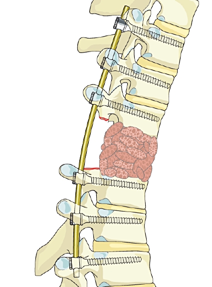 AO Surgery Reference