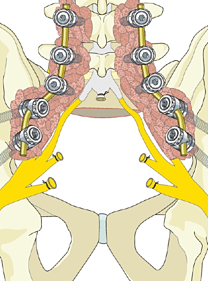AO Surgery Reference