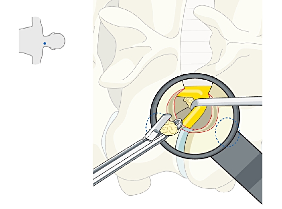 AO Surgery Reference