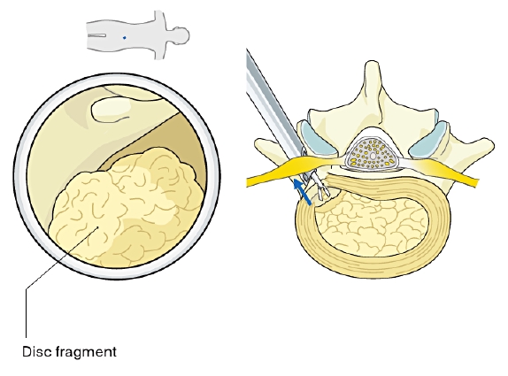 AO Surgery Reference