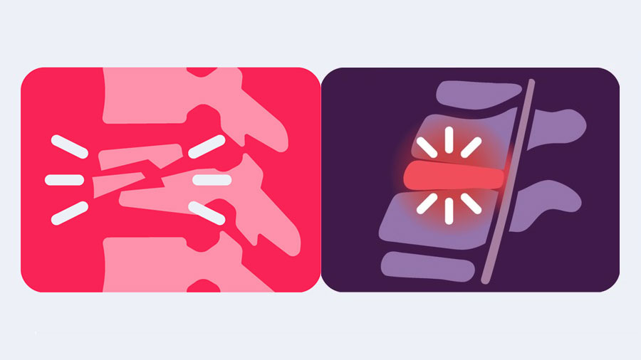 KF Trauma and Infection