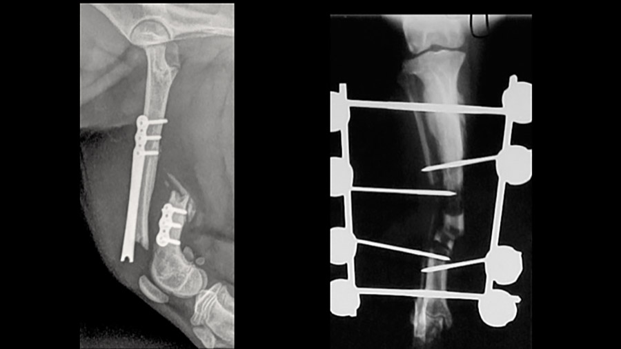 Common complications